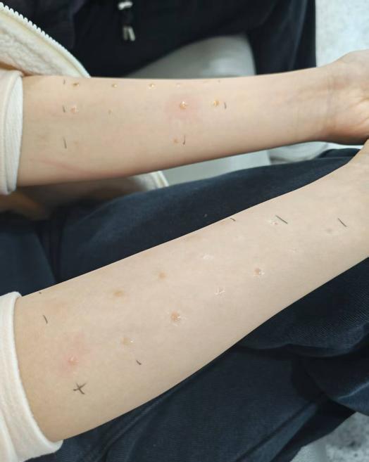  《花粉过敏为何席卷7500万人：一位过敏科医生的深度解读》 健康养生